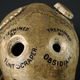 Illustration for article titled Four methods of trepanation demonstrated on a single human skull